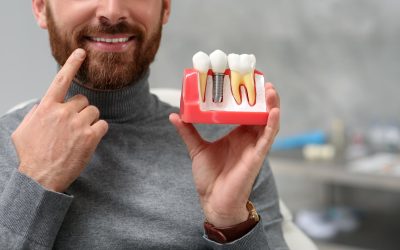 What Is Life Like With Dental Implants in Winston-Salem NC?