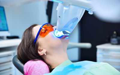 What Are the Basics of Teeth Whitening?